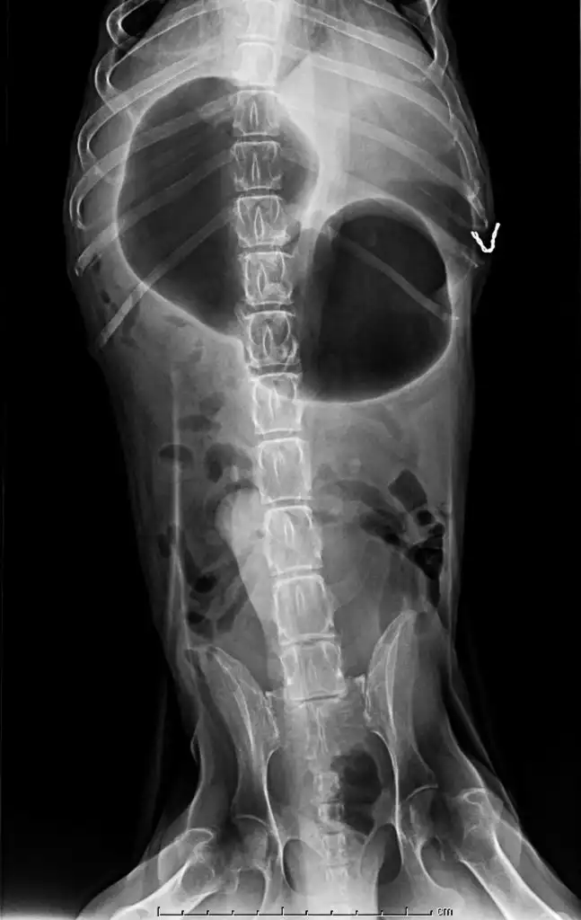 X-ray of dog anterior view with Gastric dilatation volvulus 